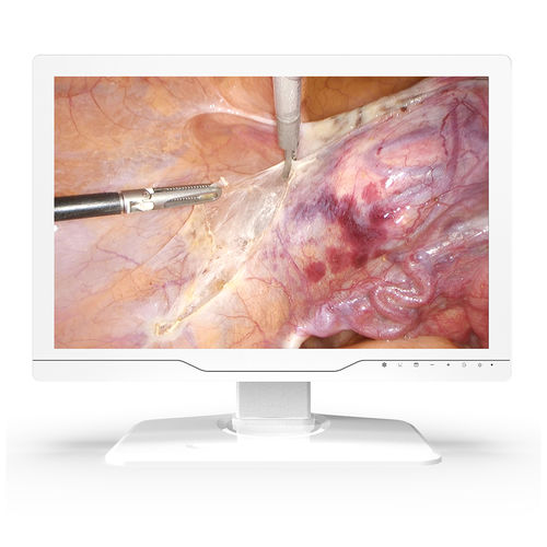 Monitor médico - 24A30 - KTC Medical Solutions - para sala de cirurgia / para endoscopia / 1920x1200