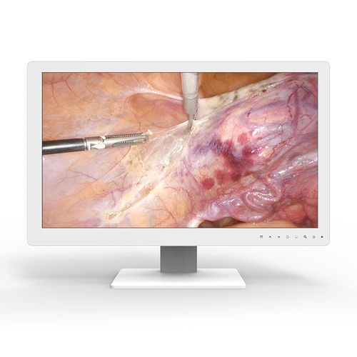 Monitor médico-hospitalar - 24A25 - KTC Medical Solutions - para sala de cirurgia / para endoscopia / 1920 x 1080