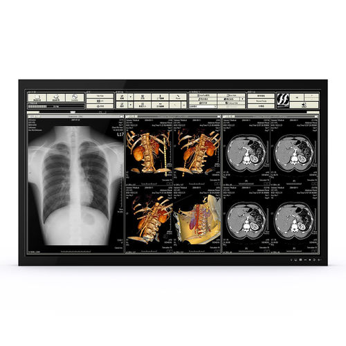 Monitor médico-hospitalar - 65H90 - KTC Medical Solutions - para sala de cirurgia / 3840 x 2160 / 65"