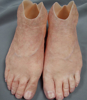 Prótese estética para pé - Medical Art Prosthetics - para adulto