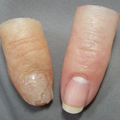 Prótese estética de dedo - Medical Art Prosthetics - para adulto