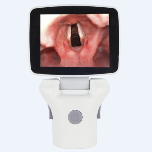 Video-laringoscópio com monitor de vídeo integrado - TL-100V-Ⅱ - Shenzhen Tianlang Medical Equipment - com lâmina