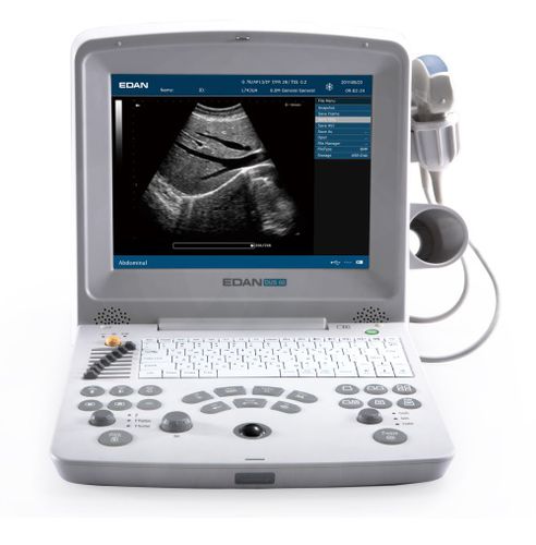 Aparelho de ultrassom portátil - DUS60 - JFB International - ginecológico e obstétrico / urológico / para exame musculoesquelético