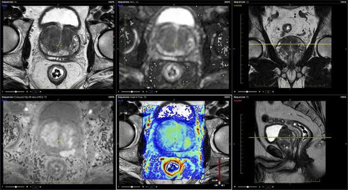Software de análise - Advantis Medical Imaging - de criação de laudos / visualizador / para RM