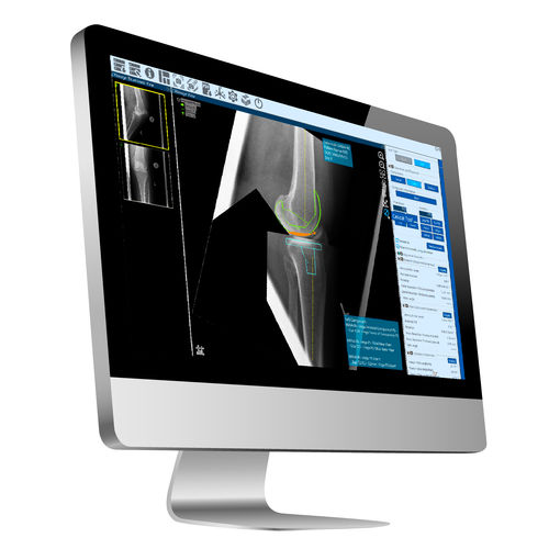Software para cirurgia ortopédica - ZedView2.5D - LEXI Co. - visualizador / de planejamento / de importação