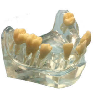 Modelo anatômico de maxilares - DM – 2002 - Selmodels SL - para cirurgia odontológica / para implantodontia / transparente