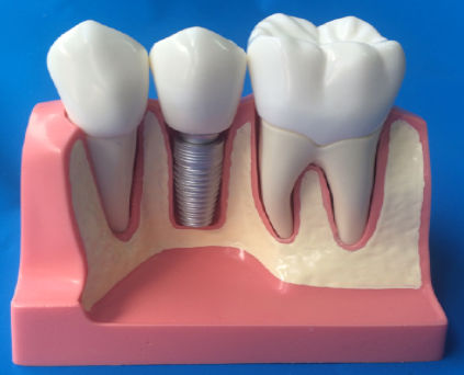 Modelo anatômico odontológico - MM-101 - Selmodels SL - para implantodontia / flexível