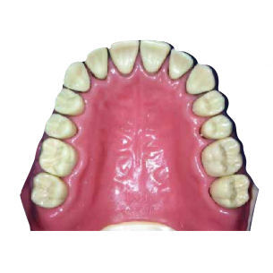 Modelo de maxilar - DM 128 - Selmodels SL - de dentes / de periodontia / para doenças odontológicas