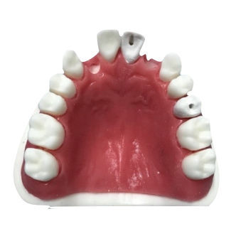 Modelo de maxilar - SS – 101  - Selmodels SL - de canal radicular / para treinamento / de sutura