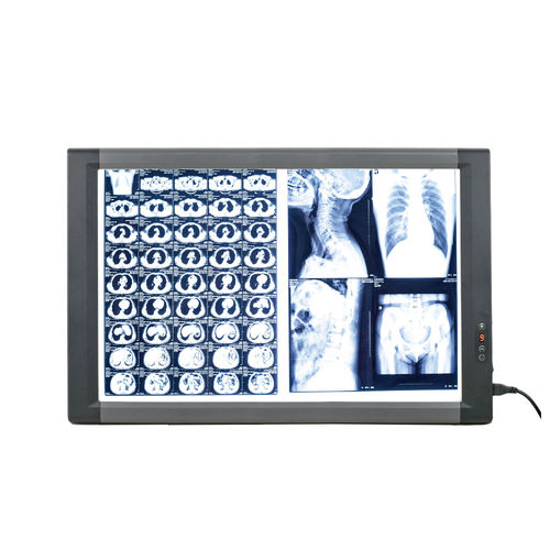 Negatoscópio digital - MG02 - Nanchang Micare Medical Equipment - 2 corpos / com interruptor / LED