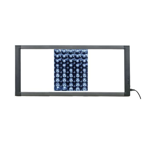 Negatoscópio digital - MG03 - Nanchang Micare Medical Equipment - 3 corpos / com interruptor / LED