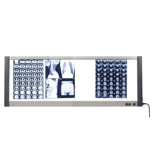 Negatoscópio 4 corpos - MG-04X - Nanchang Micare Medical Equipment - de luz branca / com interruptor / com acendimento automático
