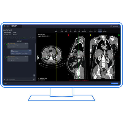Software para traumatologia - Viz.ai - de criação de laudos / visualizador / de compartilhamento