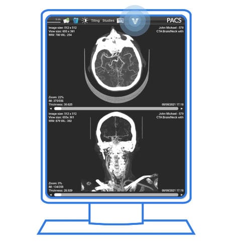 PACS com computação em nuvem - Viz.ai - para exames de imagem / para área médica