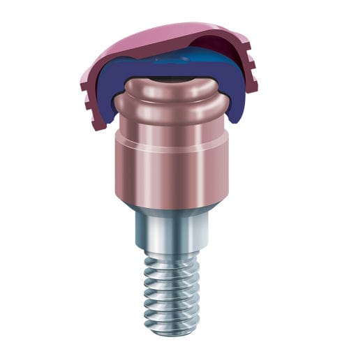 Kit de pilares odontológicos em titânio - LOCATOR R-Tx® - Zest Dental Solutions - anatômico / Locator®