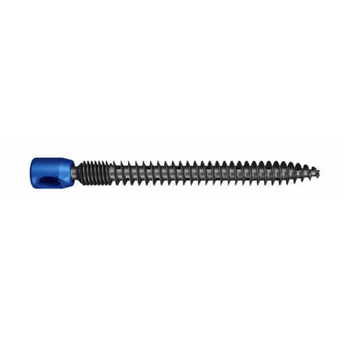 Sistema de osteossíntese sacroilíaco - polyphem® Plus - Maxxspine Innovative - via posterior