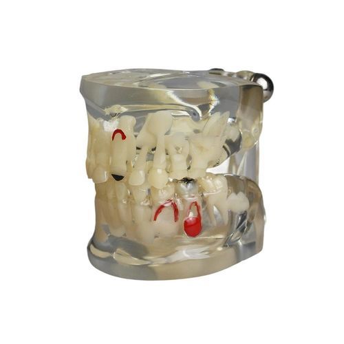 Modelo de dente - JG-Y15-RJ - FOSHAN JINGLE MEDICAL EQUIPMENT CO., LTD - de dentição / para treinamento / de criança
