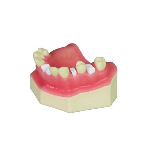 Modelo anatômico sinusal - JG-Y8-F5 - FOSHAN JINGLE MEDICAL EQUIPMENT CO., LTD - odontológico / de gengiva / de maxila
