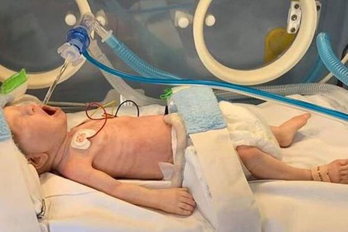 Simulador de paciente de controle de vias aéreas - PREM & FULL TERM - LifeCast Body Simulation Ltd - para RCP / para procedimentos pediátricos / de bebê