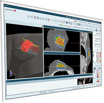 Software de planejamento de tratamento - SagiPlan® - BEBIG MEDICAL GmbH - de avaliação / para TC / para RM