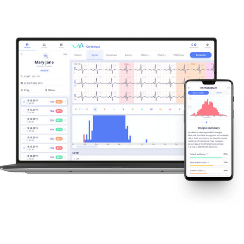 Software de análise - Cardiolyse - de gestão / de controle / de criação de laudos