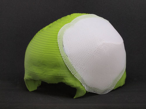 Prótese craniana absorvível - Osteoplug™ - Osteopore International
