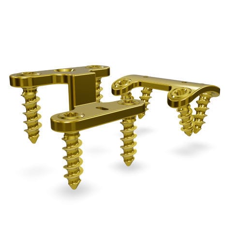 Placa de compressão óssea para metatarso - Rearfoot 3.5 system - Astrolabe - lateral / medial / bloqueada