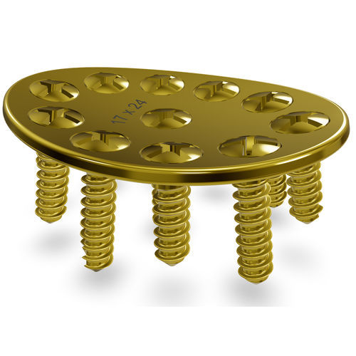 Placa de artrodese para carpo - CMS 2.3 Modular System - Astrolabe - medial / bloqueada / em titânio