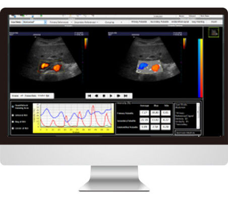 Software de análise de imagens - AmCAD-UV  - AmCad BioMed - de interpretação / para ecografia / de vasos sanguíneos