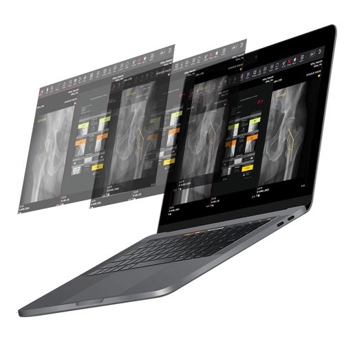 Software para cirurgia da anca - HIPPO™ - Imagebiopsy Lab - de análise de imagens / de criação de laudos / de visualização