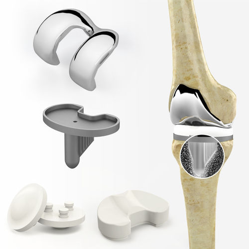 Prótese total de joelho - Zimed Medical - de deslizamento com preservação do ligamento cruzado / com plataforma móvel / cimentada