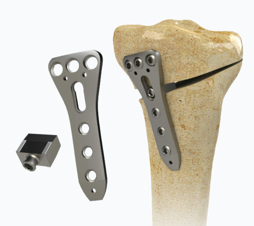 Placa de osteotomia para tíbia - 1972-0016 - Zimed Medical - proximal / medial / bloqueada