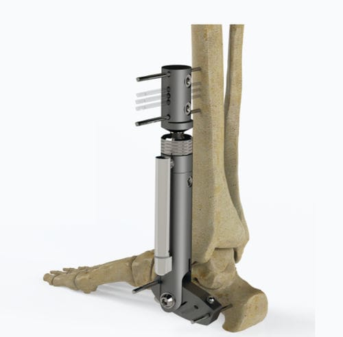 Fixador externo para tornozelo - 5064-000 series - Zimed Medical - tubular