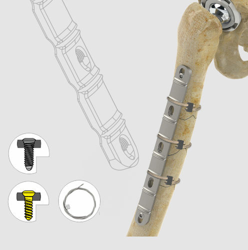 Placa de compressão óssea para grandes fragmentos ósseos - 1982 series - Zimed Medical - medial / bloqueada / metálica
