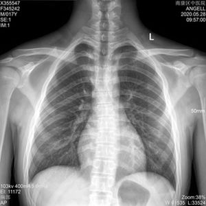 Filme radiográfico para radiografia geral - KND-A - Shenzhen Seacrown Electromechanical - 14 x 17 / 10 x 12 / 8 x 10