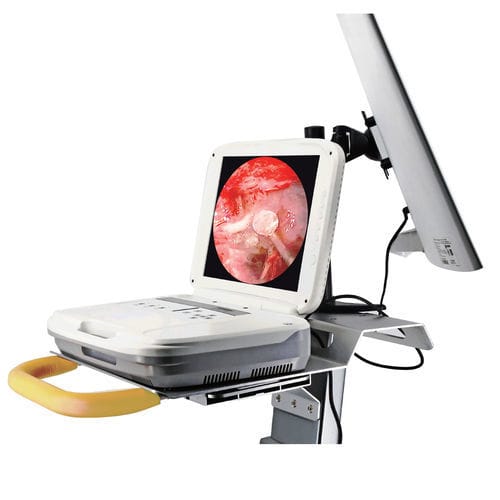 Sistema de endoscopia para neurocirurgia endoscópica - 1080P - Hotry