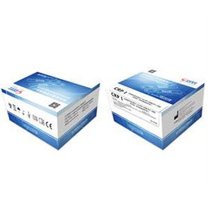 Teste rápido de COVID-19 - Zhongshan Chuangyi Biochemical Engineering Co.,ltd - de IgG / de imunoglobulinas M / de SARS-COV-2