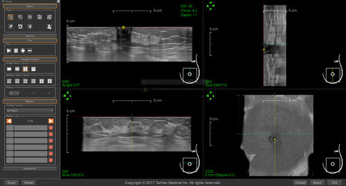 Software de criação de laudos - BR-Viewer™ - TaiHao Medical - visualizador / de diagnóstico / para rastreamento do câncer de mama