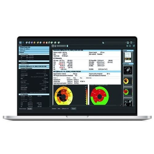 Software de análise - SPHERE® 3.0 - Olea Medical - de visualização / de medição / de mapeamento cardíaco