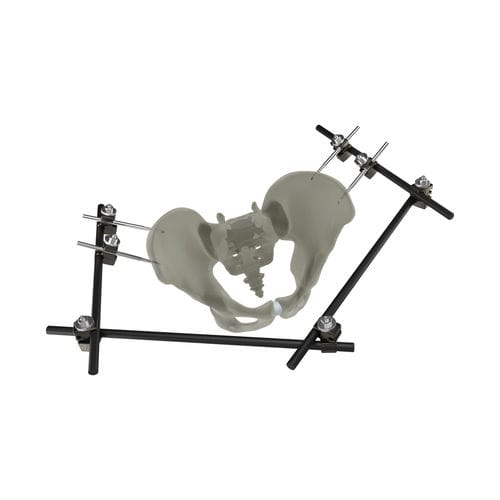 Fixador externo de pelve - UniX® - WishBone Medical - tubular