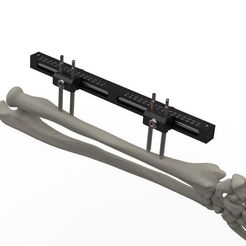 Fixador externo para punho - TF-ERS  - TASARIMMED - para rádio / para cúbito / tubular