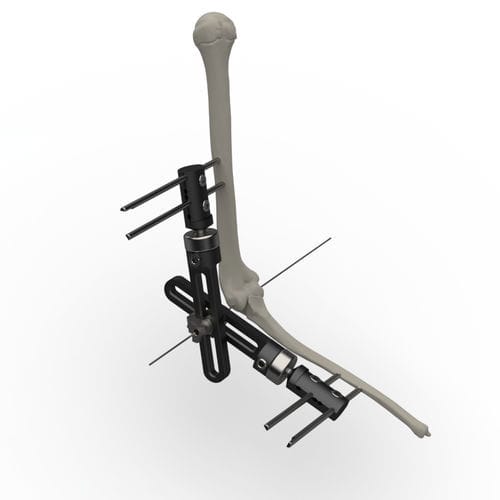 Fixador externo para cotovelo - TF-8000-1 - TASARIMMED - tubular