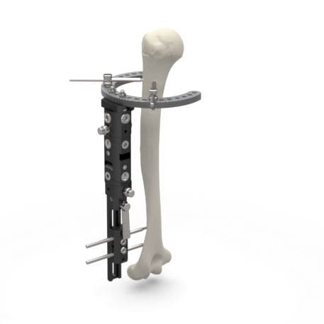 Fixador externo para tarso - MAF - TASARIMMED - para articulação metacarpofalangeana / híbrido / infantil