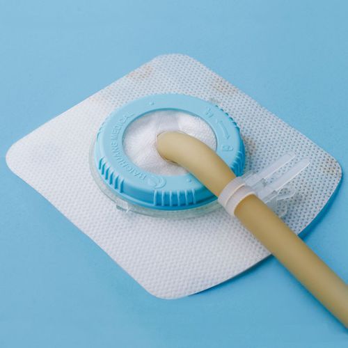 Fixador para cateter para cateter de drenagem de feridas - Loopix™  - Zhejiang Haichuang Medical Device - para tronco / adesivo