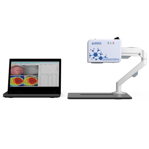 Imageador de fluxo sanguíneo - Shanghai TOW Intelligent Technology - por contraste do laser speckle