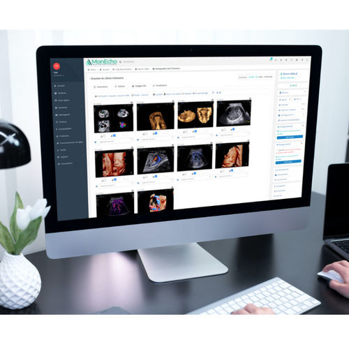 Software para ecografia - MONECHO - MonEcho - de gestão de relatório de cliente / de gestão de documentos / de gestão da medicação