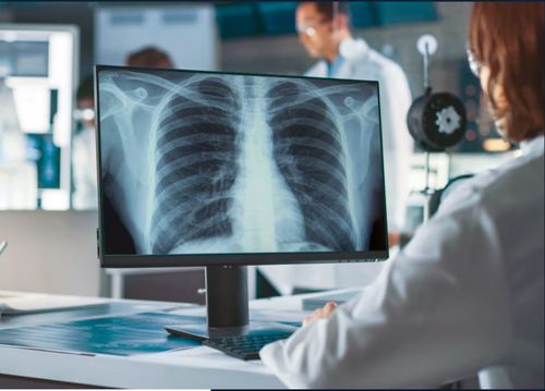 Software de diagnóstico - VUNO Med®-Chest X-ray™ - VUNO - de avaliação / para radiologia / de pulmão