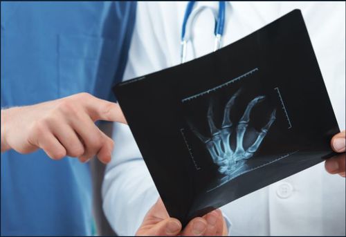 Software de diagnóstico - VUNO Med®-BoneAge™ - VUNO - de avaliação / para radiologia / de osso