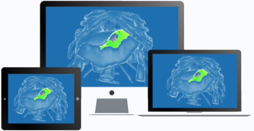 Software cirúrgico - diSplay - InSimo - médico-hospitalar / clínico / de anatomia
