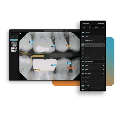 Plataforma de IA para radiografia dentária - Second Opinion® - Pearl - de análise de imagens